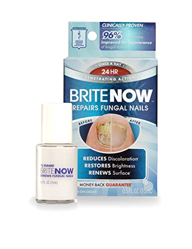 ProClearz Brite Now Nail Treatment, Restores The Appearance Of Damaged & Discolored Nails, Peel-Away Technology, Brightening & Smoothing Nail Repair, 0.5 Ounce
